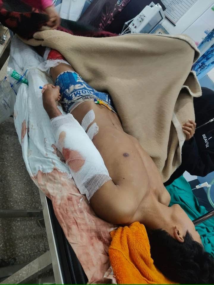 धारिलो हतियार प्रहार गरी युवक घाइते बनाएको आरोपमा दुई जना पक्राउ